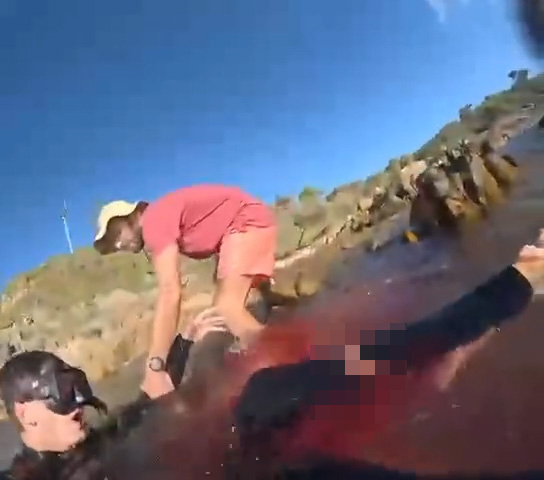 澳洲男海邊散心遇鯊魚狂噬 第一身驚險影像曝光！海水染成一片紅 