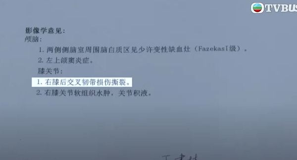 港女深圳水療中心跌倒 致韌帶撕裂花5萬元做手術 店方一理由反駁拒全數賠償