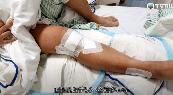 港女深圳水療中心跌倒 致韌帶撕裂花5萬元做手術 店方一理由反駁拒全數賠償