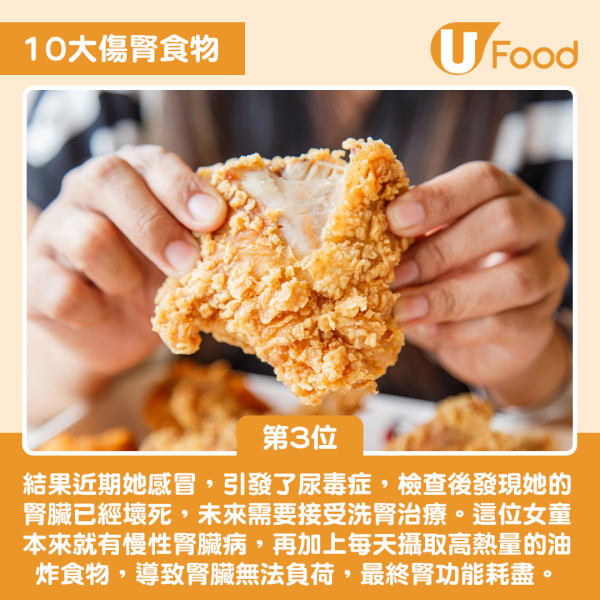 10大傷腎食物排名大公開！燒味飯排第4 一飲品高危