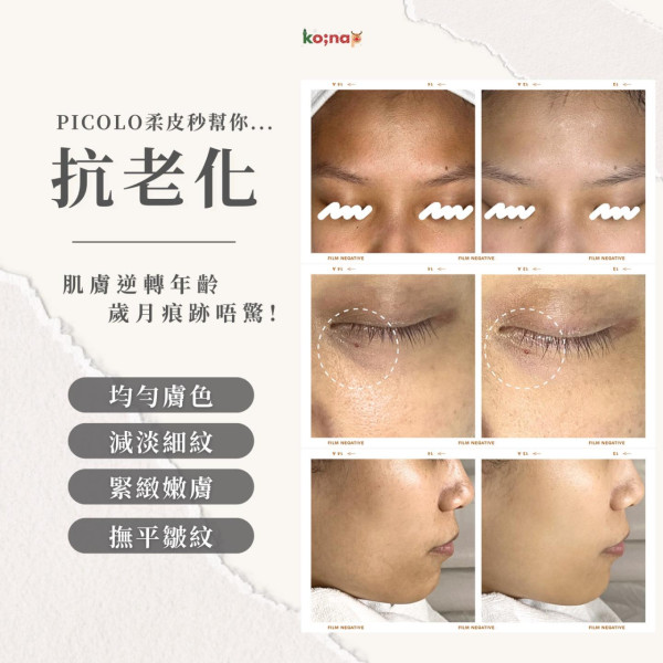 10大美容院推薦排名1：ko;nap 肌膚調理