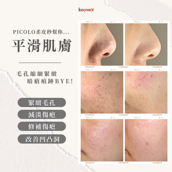 10大美容院推薦排名1：ko;nap 肌膚調理