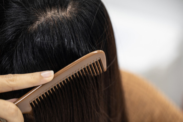 細軟髮質6大改善建議！天生髮量稀少怎麼辦？從這些養髮方法入手！