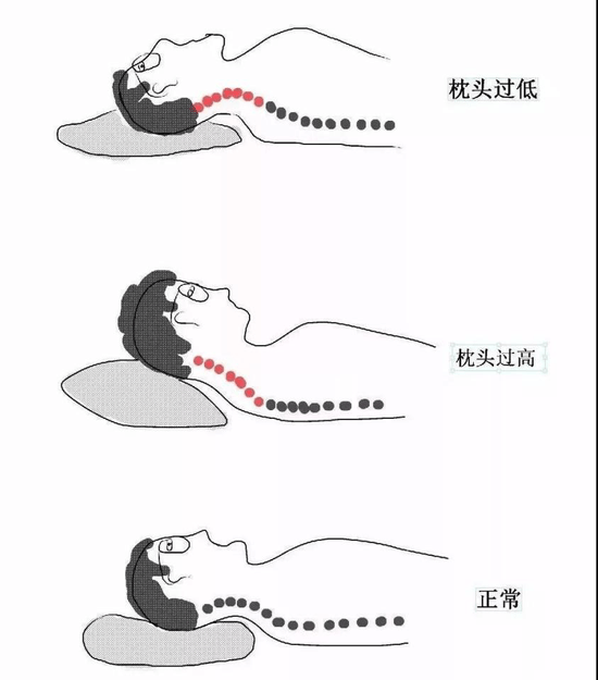 日本研究｜枕頭過高易中風 醫生警告：不宜超過12厘米【附消委會7款高分枕頭】