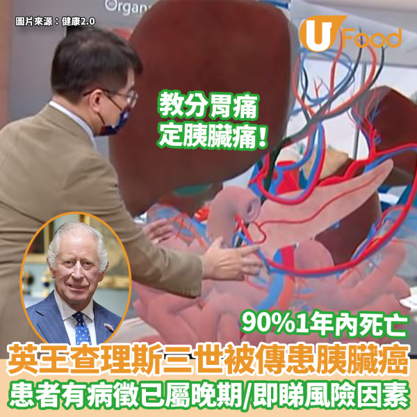 運動男無長期病患突現1身體異樣！醫生檢查發現5cm腫瘤／驚揭胰臟癌真相