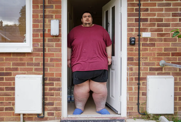 肥胖禍害｜重達700磅英國第一肥男離世 每日食量超標4倍8年未曾出門