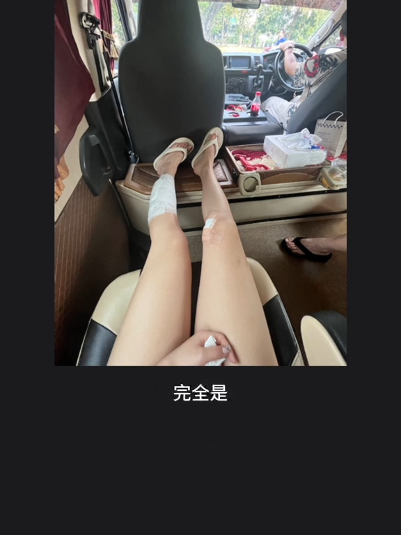 恐怖意外｜女遊客泰國參觀老虎園慘被咬傷！飼養員多次要求將臉貼近 