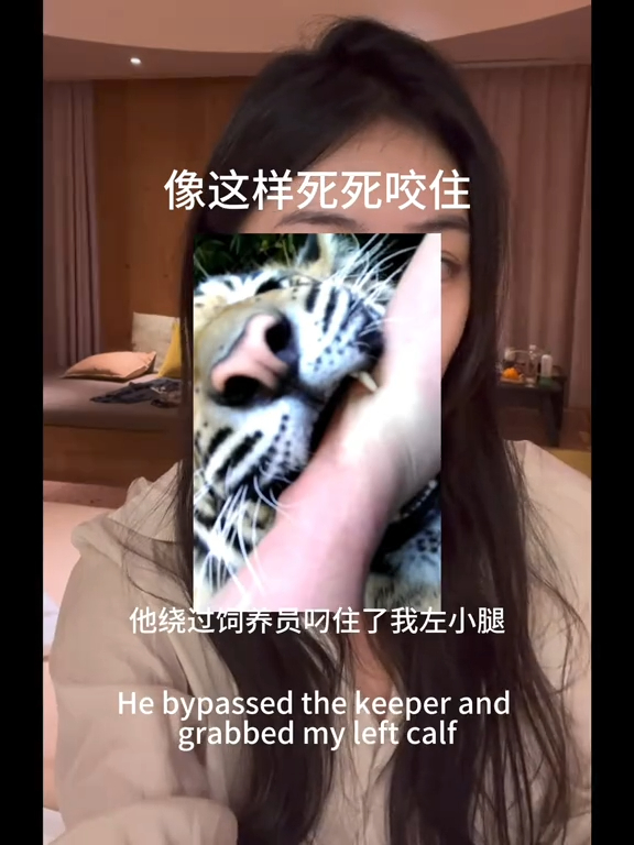 恐怖意外｜女遊客泰國參觀老虎園慘被咬傷！飼養員多次要求將臉貼近 