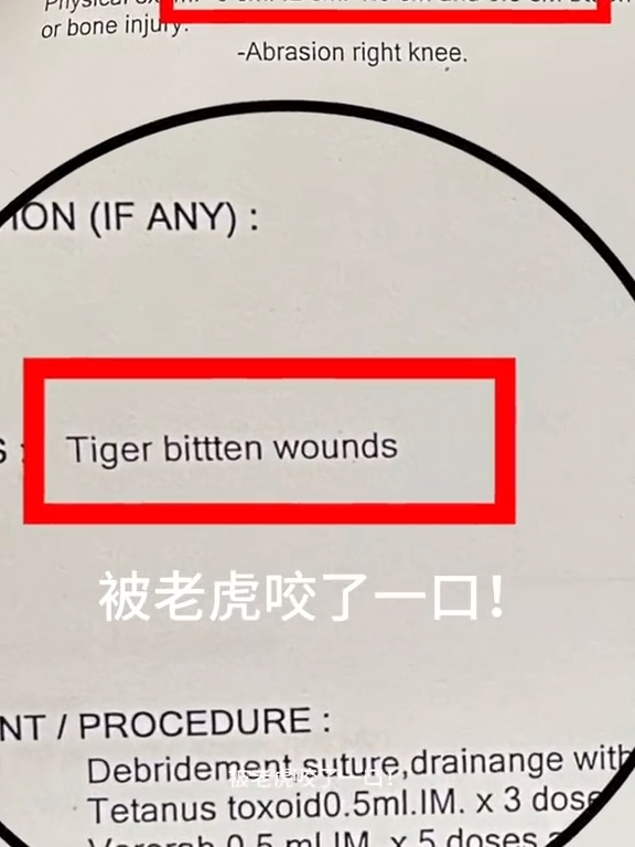 恐怖意外｜女遊客泰國參觀老虎園慘被咬傷！飼養員多次要求將臉貼近 