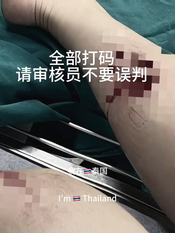 恐怖意外｜女遊客泰國參觀老虎園慘被咬傷！飼養員多次要求將臉貼近 