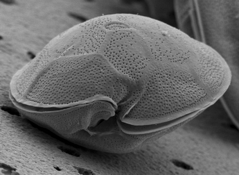 4女子疑因雪卡毒麻痺腹瀉2人需入院  衞生署：耐熱煮熟都無用／可影響神經系統