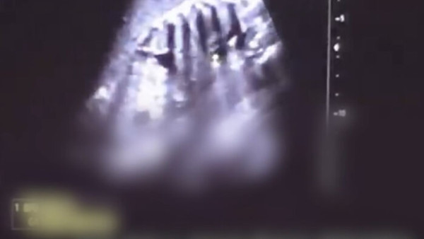 南韓女子懷孕36周墮胎 拍Vlog分享詳情被警以謀殺調查