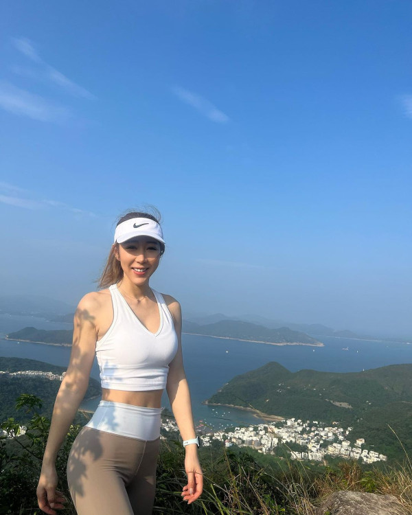 TVB咪神飛韓國做醫美打針 大方公開術後皮膚狀態嚇人