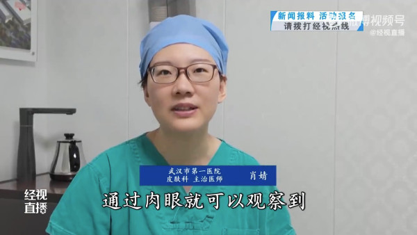 主診醫生肖婧。（影片截圖）
