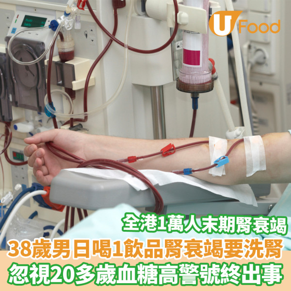 早餐戒1食物半年減15磅 70歲婦成功逆轉脂肪肝