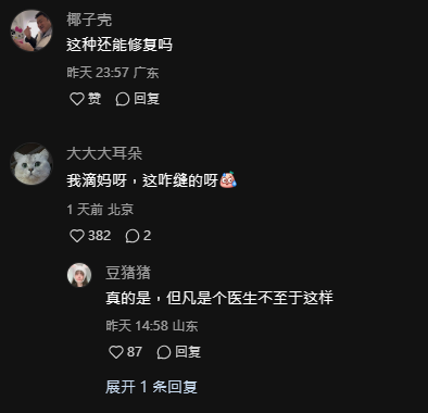 恐怖慎入｜女子內地花3萬元割雙眼皮 眼球眼皮慘被縫起無法轉動 