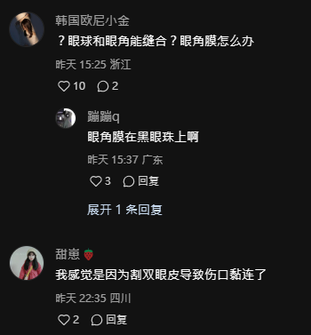 恐怖慎入｜女子內地花3萬元割雙眼皮 眼球眼皮慘被縫起無法轉動 