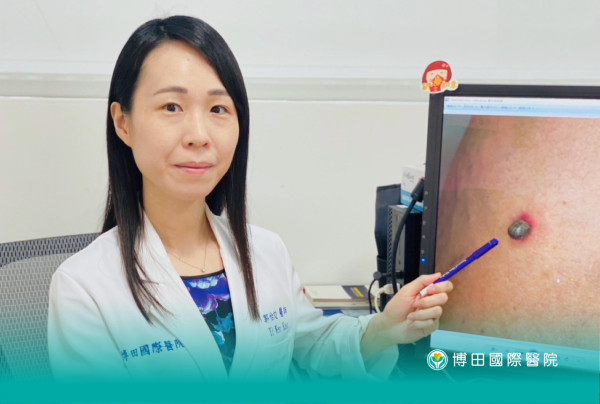 六旬翁遊日本後小腿現神秘黑色「瘜肉」 醫生證竟是吸血怪蟲鑽進皮膚