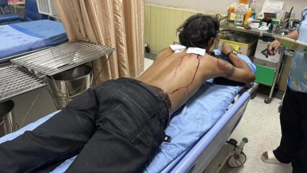 夫妻遊曼谷酒店驚遇持槍劫匪！五星級酒店兩大保安漏洞！1房型最危險？ 