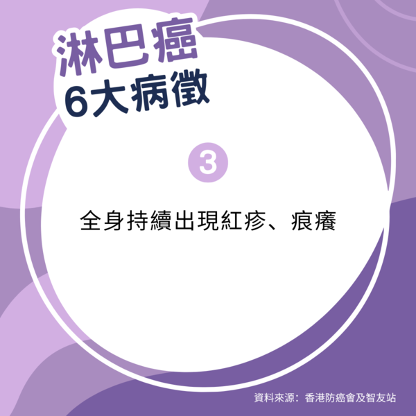 淋巴癌｜婚前摸到腫塊 婚後10日確診末期淋巴癌 28歲女化療半年奇蹟康復