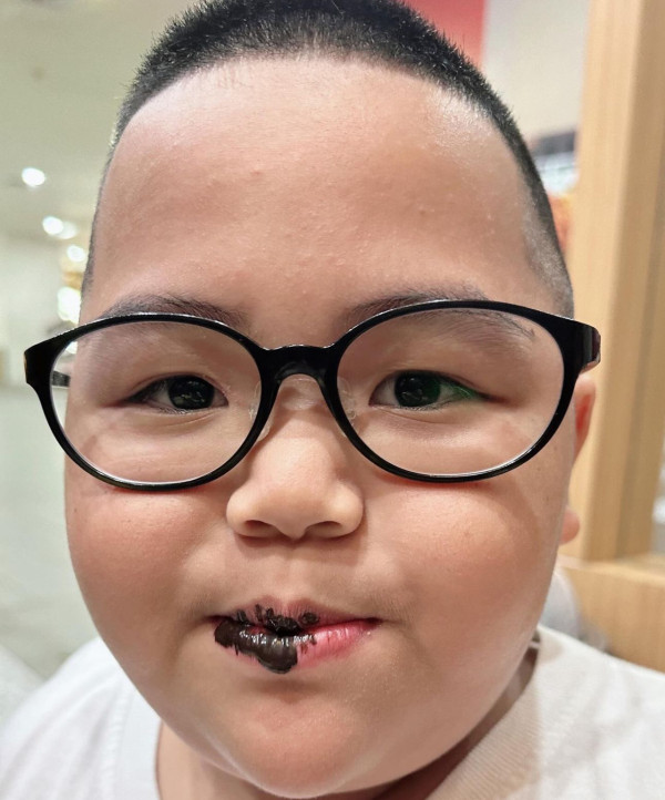 Stickers印尼肥仔Tatan11歲近照曝光!棄標誌性光頭!網民:認唔出!