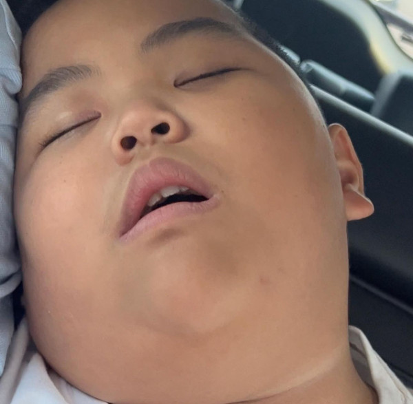 Stickers印尼肥仔Tatan11歲近照曝光!棄標誌性光頭!網民:認唔出!