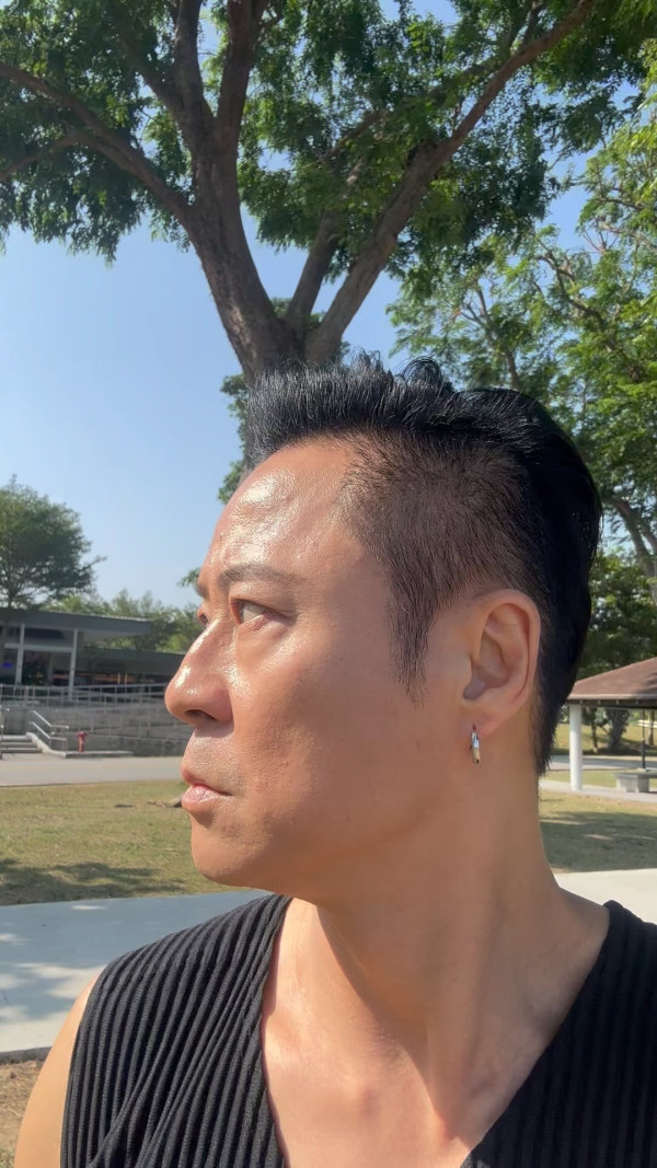 草蜢57歲蔡一傑缺席美國巡唱 驚揭罹腦瘤 PO頭頂巨型傷口報平安 