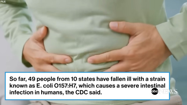 美國麥當勞爆大腸桿菌疫情 49人進食同款漢堡後中毒 1死10人住院