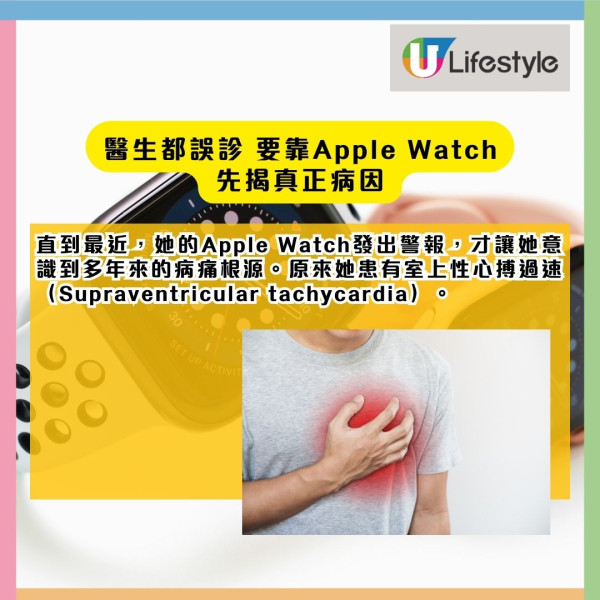 Apple Watch 竟比醫生更可靠？女子十年病因不明 全靠Apple Watch揭真相