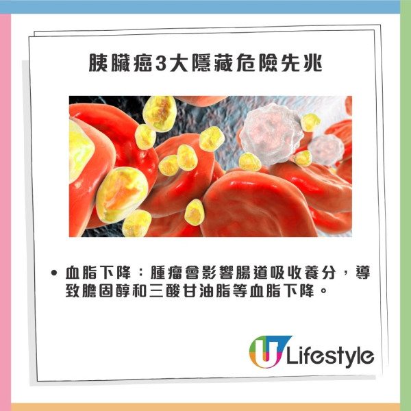 婦人血糖高半年後確診胰臟癌4期！醫生揭3大隱藏危險先兆