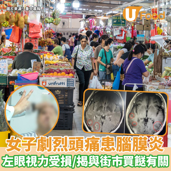 國內女子這樣用智能手機 左右眼近視度數差距多達 XXX 度