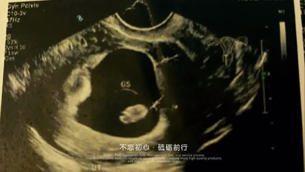 「屯門娜娜」宣布誕下兒子 曾與Happy伯屯門公園勁歌熱舞成熱話