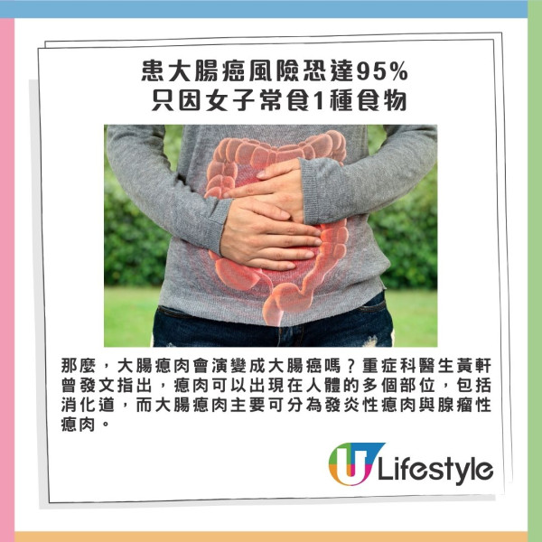 女子減肥常吃1食物 半年後驚見10顆瘜肉 患大腸癌風險恐達95% 附12種徵兆