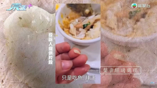 早前王小姐食魚時牙套突然爆裂。