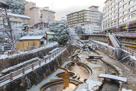 港女日本溫泉之旅變驚險｜臉部腫脹流膿急診求醫 專家教你正確的浸泡方式！