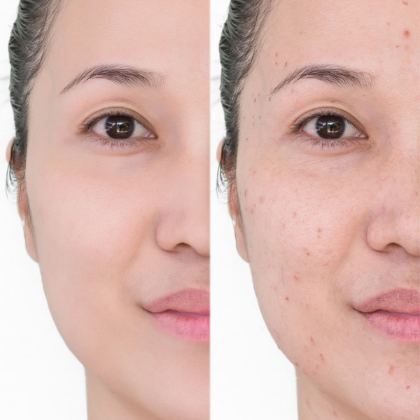 全面解析熊貓針