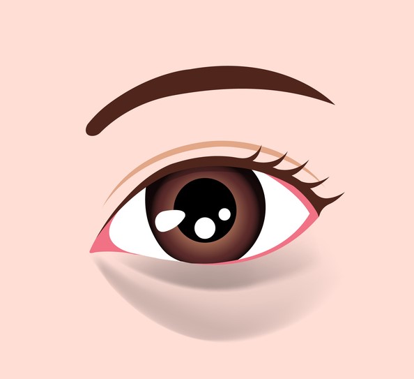 3. 結構型黑眼圈|黑眼圈在不同光線下明顯程度不同,拉扯皮膚時顏色可能變淡或消失。