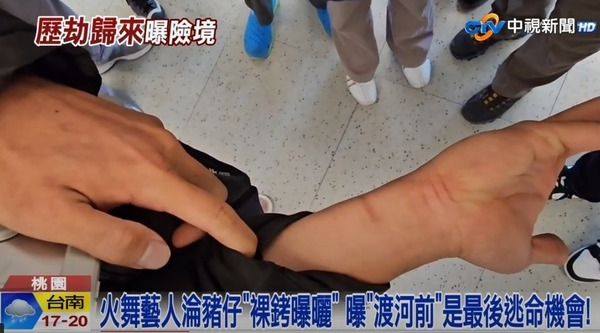 KK園區｜火舞表演者被賣豬仔後獲救 憶述園內恐怖經歷！曾被毆打兼暴曬 