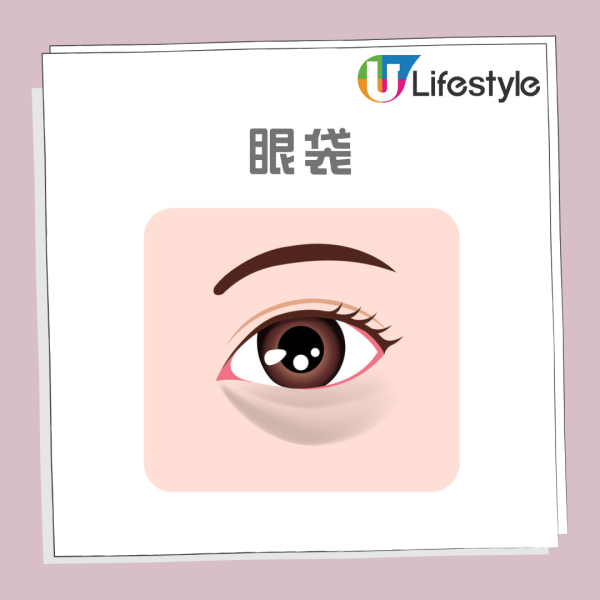 眼袋槍原理效果