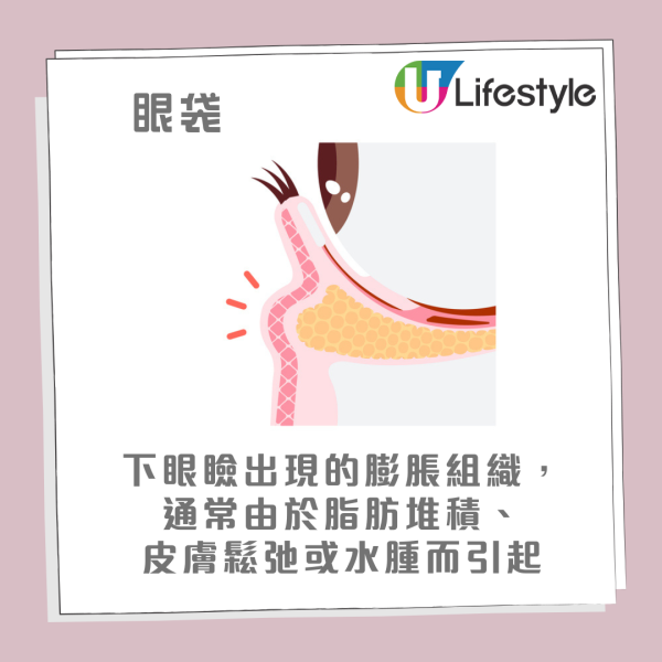 眼袋槍原理效果