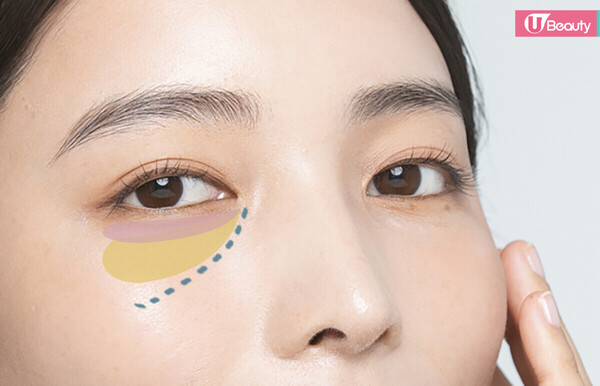 眼袋槍原理效果