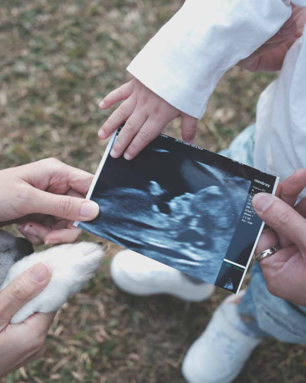 前TVB女星佗B飛馬爾代夫度假 泳裝曬纖瘦身材 上圍明顯升級 