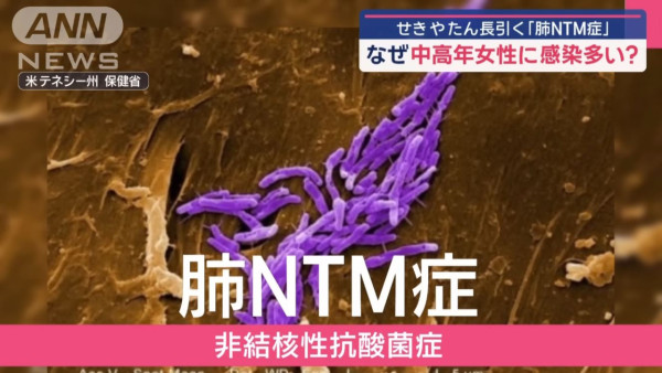 遊日注意｜不止流感！日本NTM肺病肆虐 中高齡女性及從事這行業成高危群組 