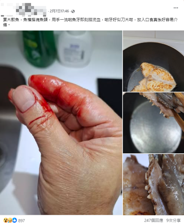 港人洗魚頭𠝹傷成手血 驚揭內藏「刀片」！網民憂染食肉菌籲求醫：魚鰭插手 差啲要做手術！