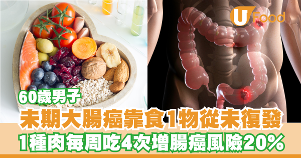 大腸癌｜60歲男末期大腸癌靠食1物從未復發！1種肉每周吃4次增腸癌風險20%