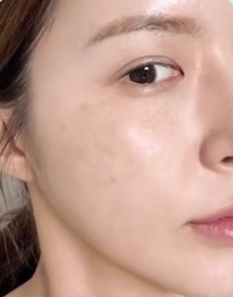 韓國護膚品推薦｜銷量排名8位. Mediheal 積雪草瑕疵修護精華