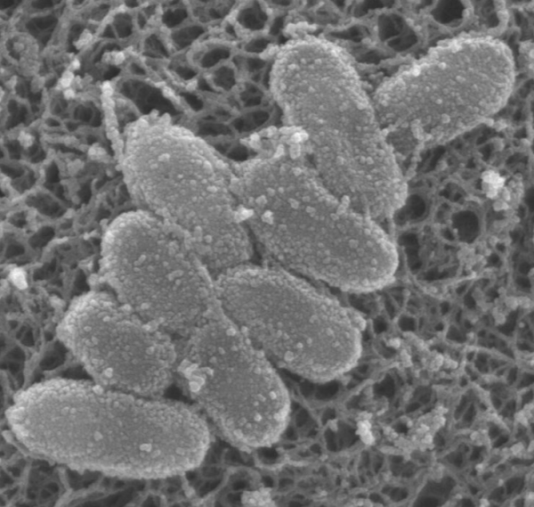 日本百日咳｜日本百日咳感染個案達7年新高 各地現「抗藥性菌」 即睇各縣感染情況 