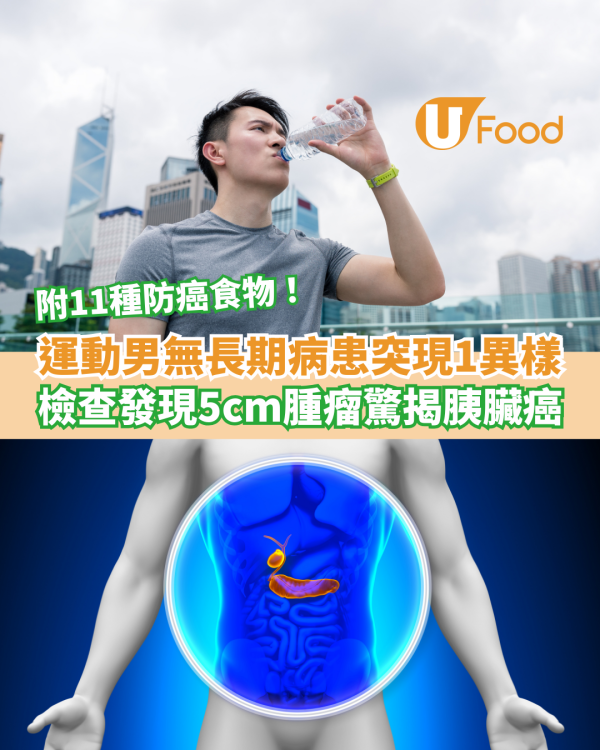 運動男無長期病患突現1身體異樣！醫生檢查發現5cm腫瘤／驚揭胰臟癌真相