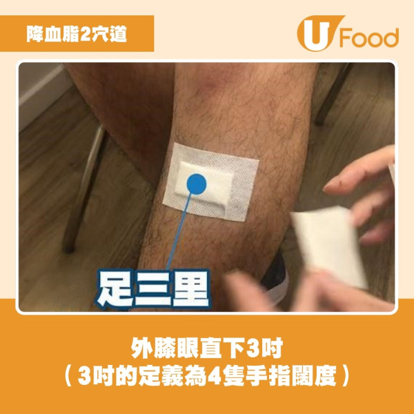 【改善高血脂】中醫教煲山楂決明子茶、洛神荷葉茶！按穴位足三里穴、天樞穴助降血脂