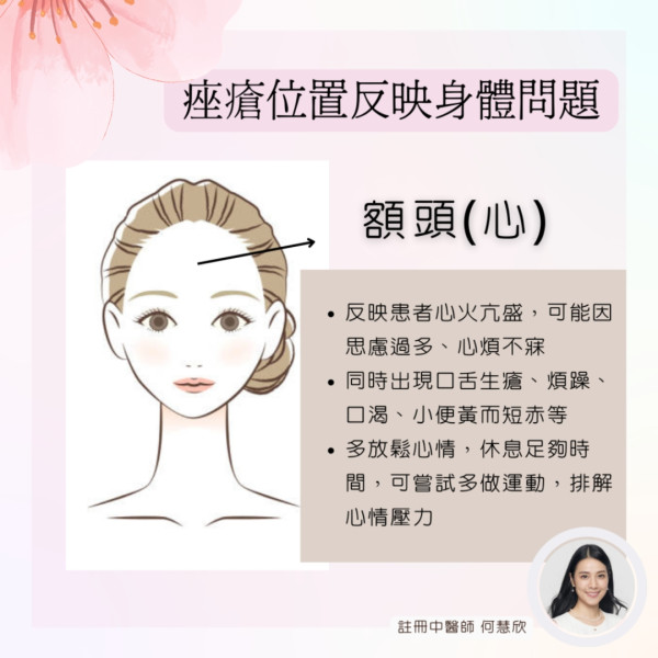 暗瘡4位置成因